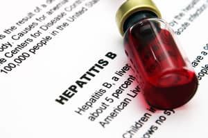 guaranteed issue life insurance hepatitis c liver disease